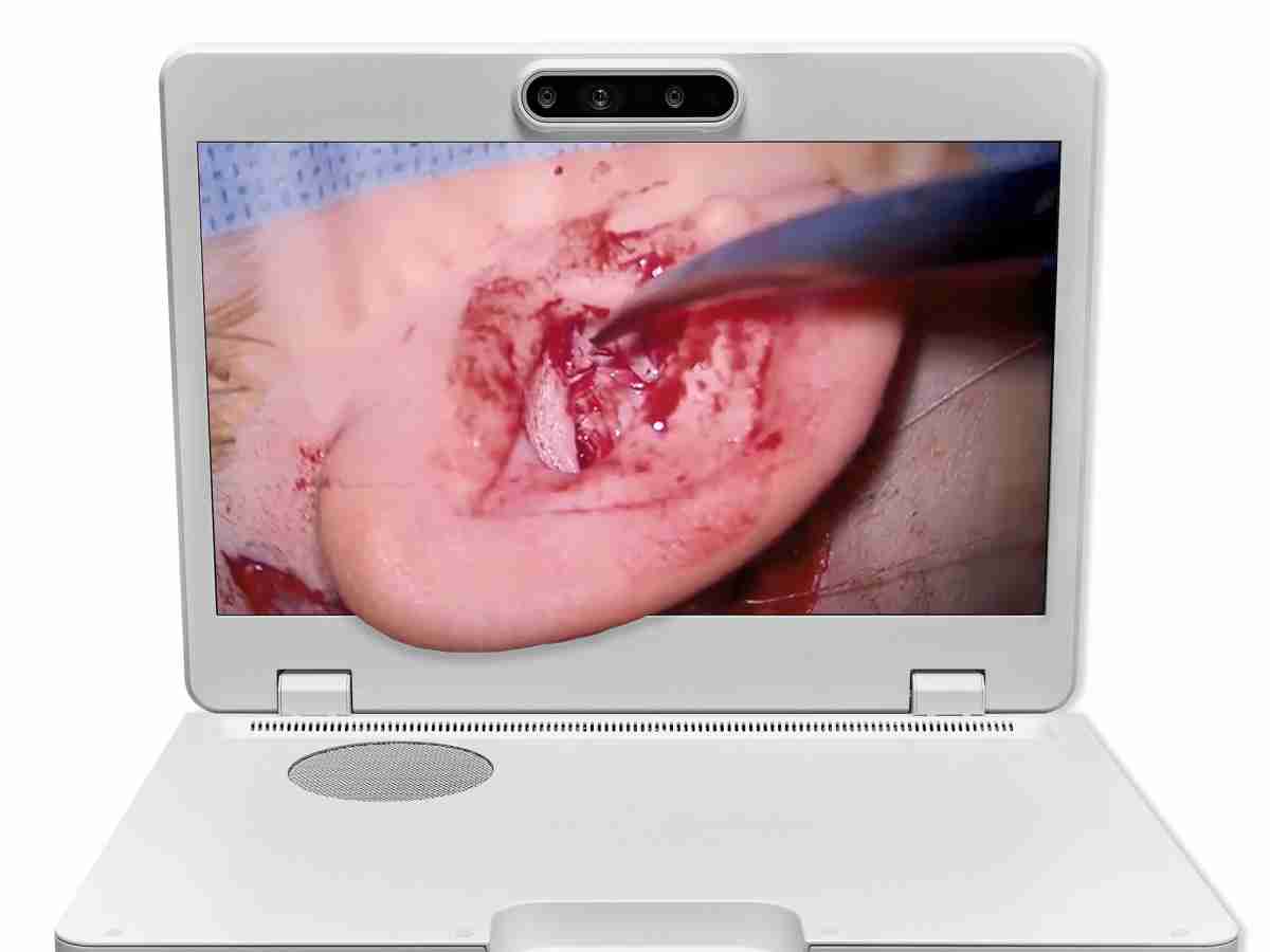 达擎之＂Heads-up 3D显微手术显示系统＂，，整合4K裸眼3D显示及眼球追踪系统，，，具备快速追踪人眼移动位置功能，，减轻医师长时间维持固定姿势的负担，，，让医师能有更宽广清晰的3D立体视野及更舒适的姿势来执行手术。。。。